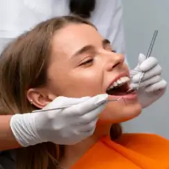 Effective Dental Fillings in Ottawa to Restore Your Smile